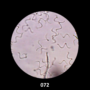 072