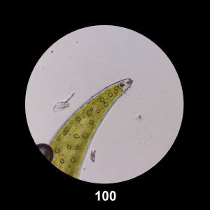 100